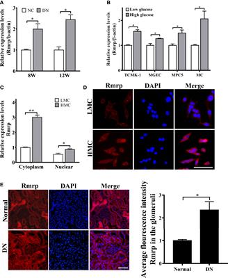 Sp1-Induced lncRNA Rmrp Promotes Mesangial Cell Proliferation and Fibrosis in Diabetic Nephropathy by Modulating the miR-1a-3p/JunD Pathway